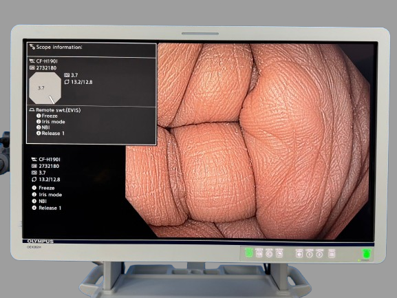 Olympus™ CF H190I : EVIS EXERA III, CLV-190 Scope Lenght: 1.3m length Biopsy channel of 3.7mm